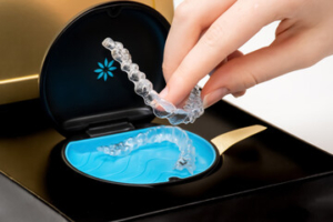 Segredo da manutenção fácil do Invisalign em BH