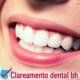 clareamento dental bh