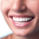 limpeza dental bh