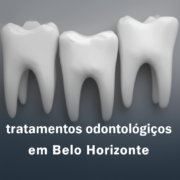 tratamentos odontológicos em Belo Horizonte